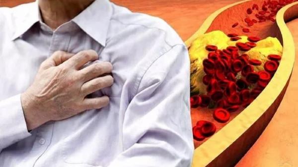 مشروب ساخن يكسر الكوليسترول ويخفض مستوياته المرتفعة!