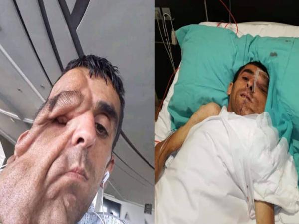 البسمة تعود للشاب التطواني "علي" بعد عملية أولى ناجحة باسبانيا