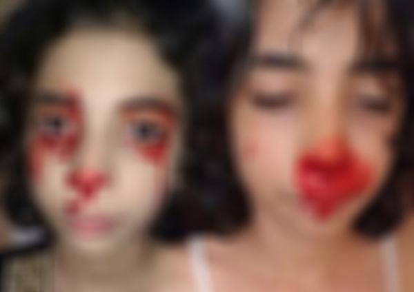 القنيطرة .. قصة الطفلة "آيـة" التي تُعاني من مرض غريب حار الأطباء في معرفة أسبابه