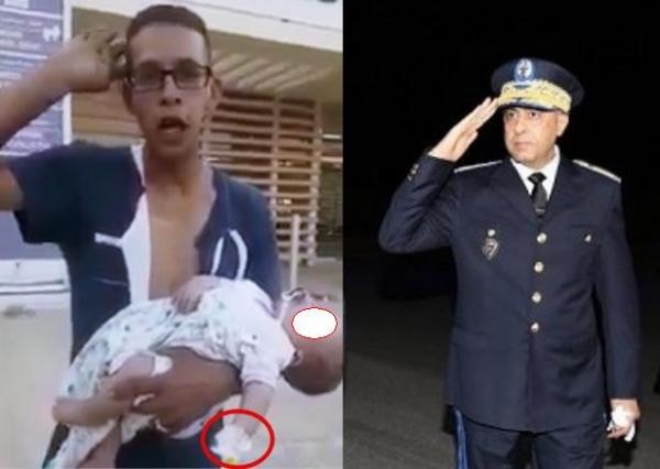 بالفيديو : مواطن يتهم شرطيا بكسر ذراع ابنته الصغيرة والحموشي يدخل على الخط