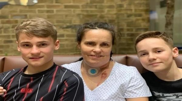 أطباء يتمكنون من بناء لسان بريطانية تعاني من السرطان باستخدام أنسجة وأوعية دموية من ساقها