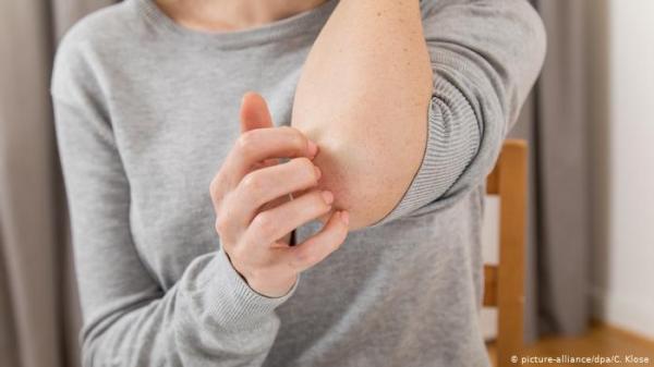 عليك بالطبيب فورا.. إذا كنت تعاني من حكة متواصلة