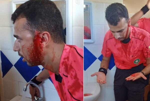 خطير جدا: مسيرو فريق بقسم الهواة يعتدون على حكام بطريقة وحشية جدا (صور)