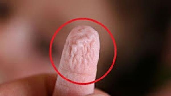 هل تعلم السبب وراء تجاعيد أصابع اليد غريب جدا!