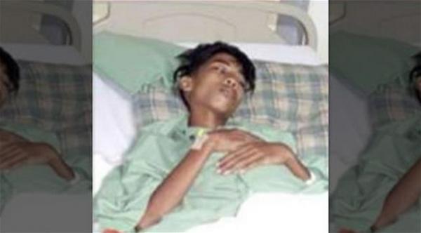 إزالة شقيق توأم بقي داخل بطن شاب 15 عاماً