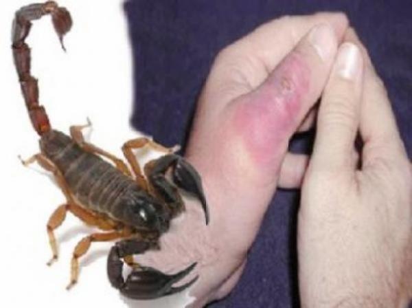 العقارب تتحدى بلاغ "الدكالي"... لسعة عقرب تنهي حياة طفل حل ضيفا من فرنسا وطفلة ثانية من نفس المنطقة تحتضر في منزلها لغياب المصل!