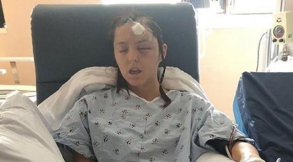 امرأة تخضع لعملية جراحية لإزالة ورم سرطاني من الدماغ دون تخدير