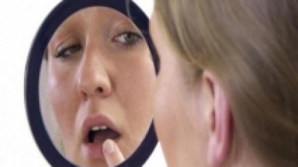 إليك طرق طبيعية تساعد في علاج تورم الشفاه