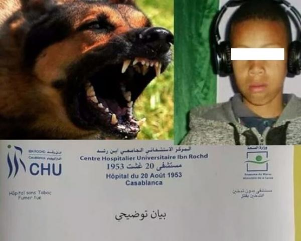 وزارة الصحة تتكفل بمصاريف علاج الطفل الذي نهشته الكلاب الضالة و هذه حالته الصحية