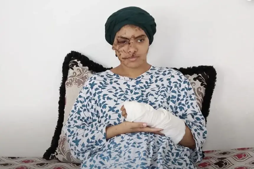 جنايات تازة تقتص لـ "ضحية التشويه"..15 سنة سجناً نافذاً في حق طليق "إيمان"