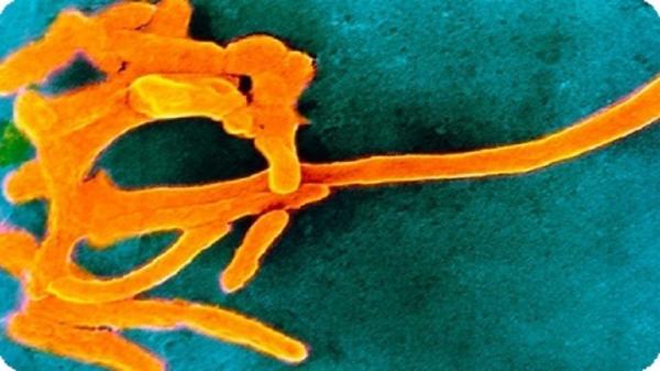 الفم غير النظيف قد يسبب سرطان المستقيم