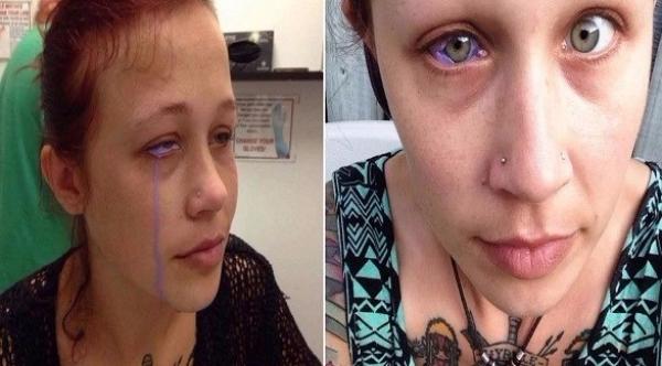 بالفيديو: هذه المرأة تذرف الدموع بلون بنفسجي