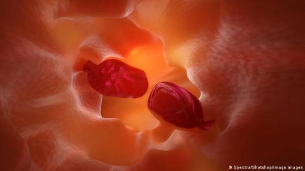 متى تصبح الزوائد اللحمية خطيرة؟