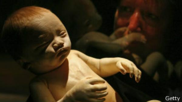 بحث أمريكي يحدد نوعا من البكتيريا يسبب الولادة المبكرة