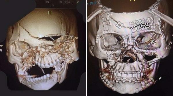 لهذا السبب يجب أن تضع حزام الأمان في السيارة