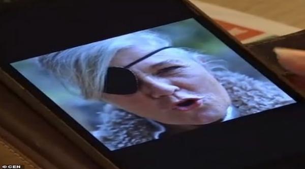 تفقد إحدى عينيها بسبب استحمامها و هي ترتدي العدسات اللاصقة