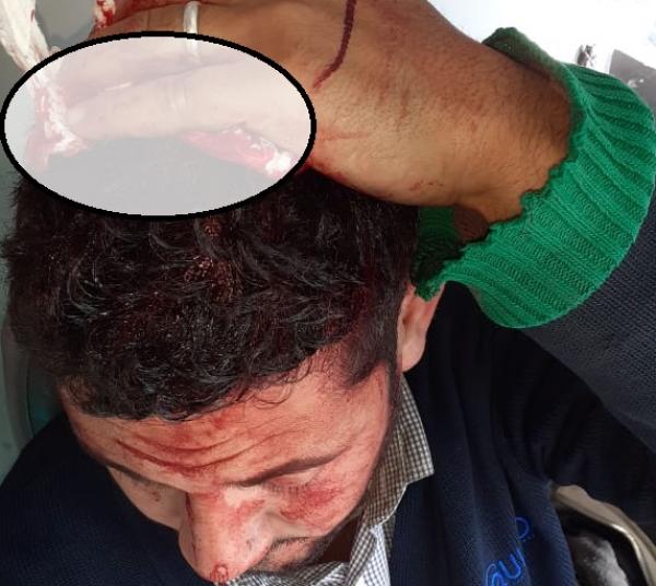 بالصور:اعتداء وحشي يطال سائق حافلة بالجديدة وهذا ما وقع