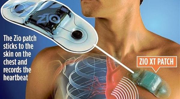 لاصق طبي يُنقذ مرضى القلب من السكتة القاتلة