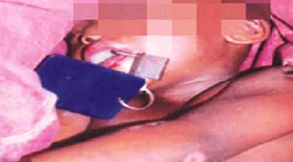 أزعجه بكاء طفله.. فقتله بزرع قفل في فمه