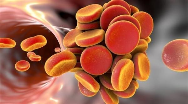 دواء للحساسية يعالج جلطات الدم العميقة