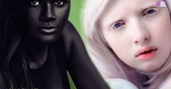 بالفيديو.. 5 فتيات يمتلكن أغرب لون بشرة في العالم