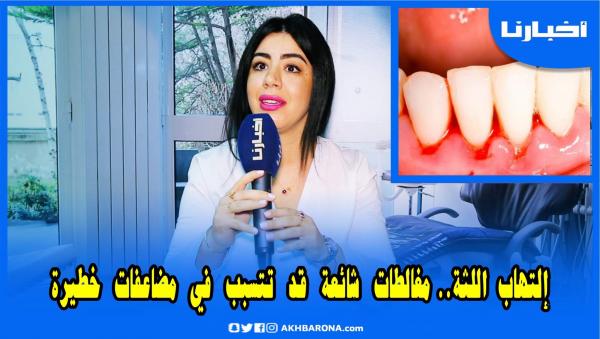 التهاب اللثة: أخطاء شائعة قد تتسبب في مضاعفات صعبة.. طرق الوقاية والعلاج