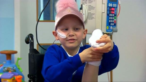 أطباء ينقذون حياة طفلة بتركيب قدمها بشكلٍ معكوس