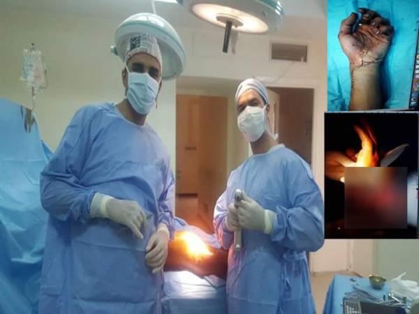 تفاصيل نجاح عملية جراحية لإعادة يد مبتورة لشاب بعد تعرضه لحادث اعتداء بسيف بالفقيه بن صالح