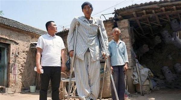 شاب صيني طوله يتجاوز المترين لا يتوقف عن النمو
