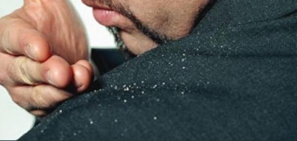 حل نهائي يخلصك من قشرة الشعر في الشتاء