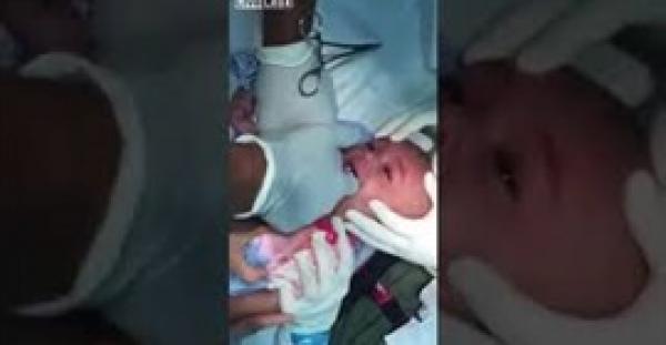بالفيديو.. طبيب يزيل ساعة من فم طفل
