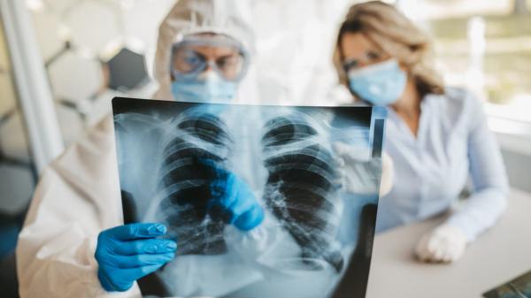كيف تتعافى الرئتان بعد الاصابة ب "كوفيد-19"؟ اليك الجواب