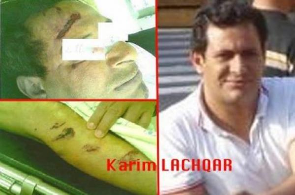 مصادر طبية : التشريح أظهر أن وفاة كريم لشقر كانت بسبب أزمة قلبية حادة