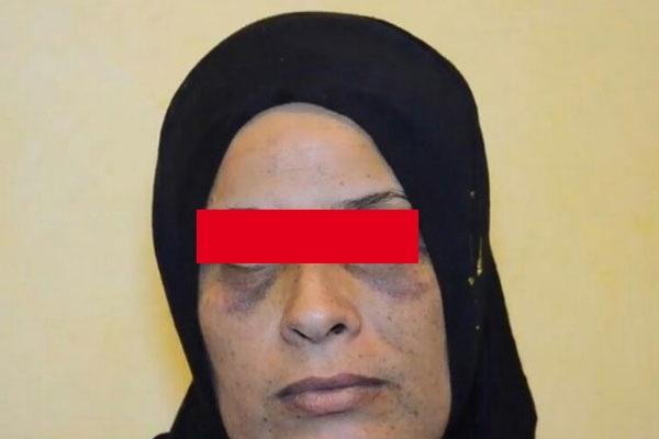 أمن البيضاء يتفاعل مع فيديو سيدة تدعي تعرضها للضرب والجرح من طليقها