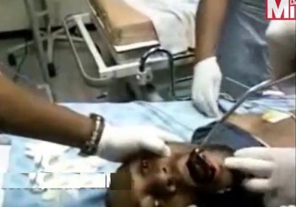 بالفيديو: هاتف جوال يعلق في حنجرة رجل أفريقي و الأطباء يسخرون