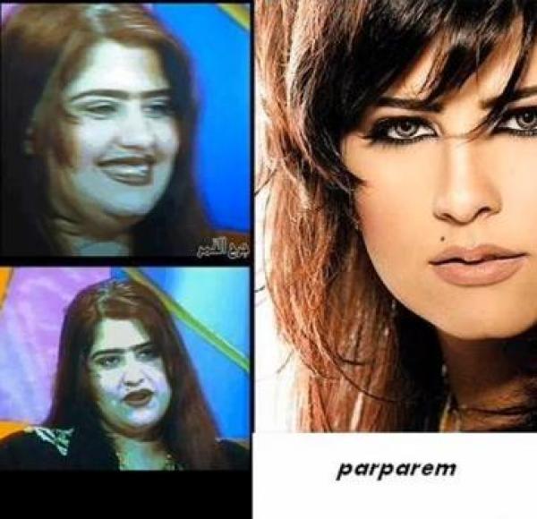 فنانات عربيات قبل وبعد عمليات تجميل 