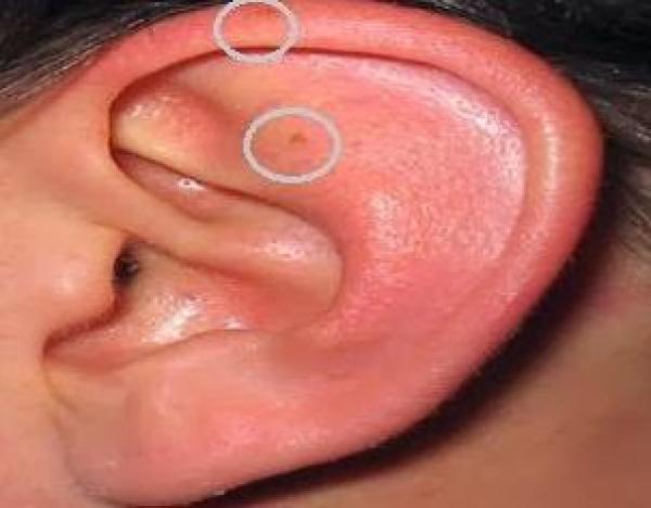 كيف تتأكدين من عذرية الرجل؟