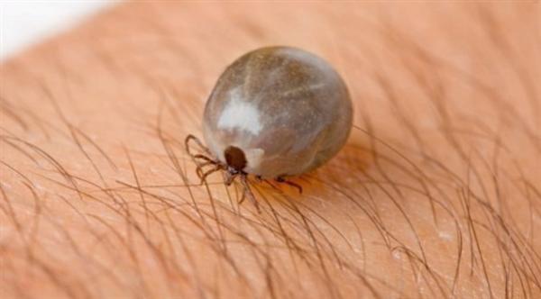 أول إصابة بالتهاب الدماغ الناجم عن لدغة القراد في بريطانيا