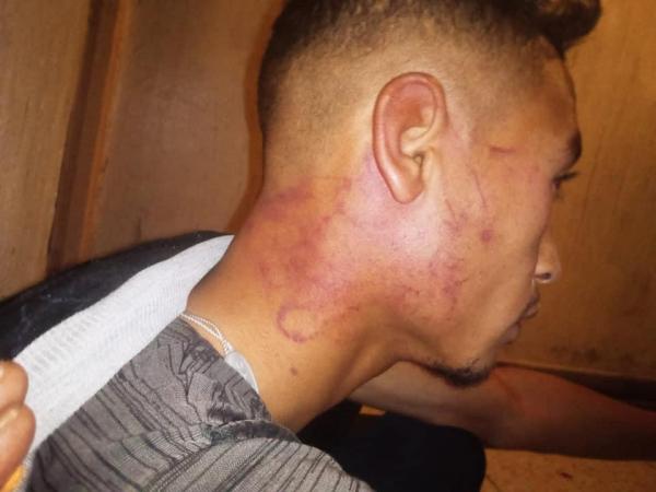 الأمن يحقق في شكاية طالب يتهم عناصر الشرطة باحتجازه والاعتداء عليه بزاكورة