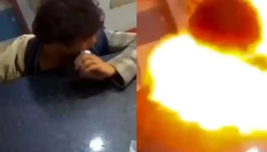 فيديو يوثق لحظة انفجار بطارية هاتف داخل فم مراهق بعد قضمها