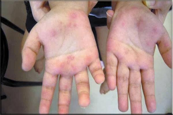 مجهولون يختطفون طفلا "زوهري" من أمام باب مدرسته بالدار البيضاء ودعوات لشن حملة فايسبوكية لإعادته لأهله