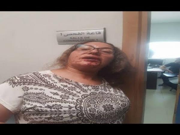 مديرية الأمن تُقدم روايتها بشأن "تعنيف" شرطي لسيدة بوجدة ..وهذا ما قررته (فيديو)