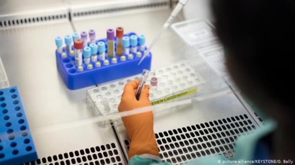 لأول مرة .. إزالة فيروس نقص المناعة من حيوانات حية