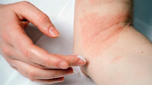 ماهي الأسباب وراء ظهور البقع الحمراء على الجسم؟