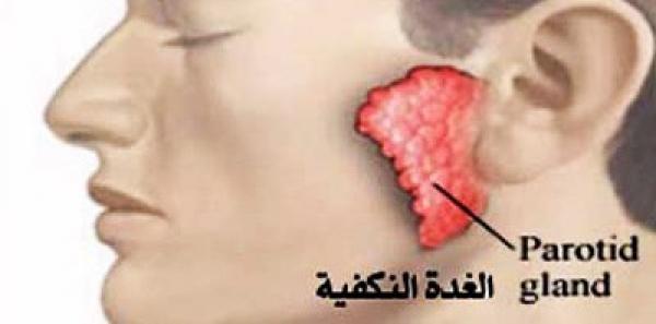 وزارة الصحة عزلت 82 تلميذا بعد إصابتهم بمرض النكاف