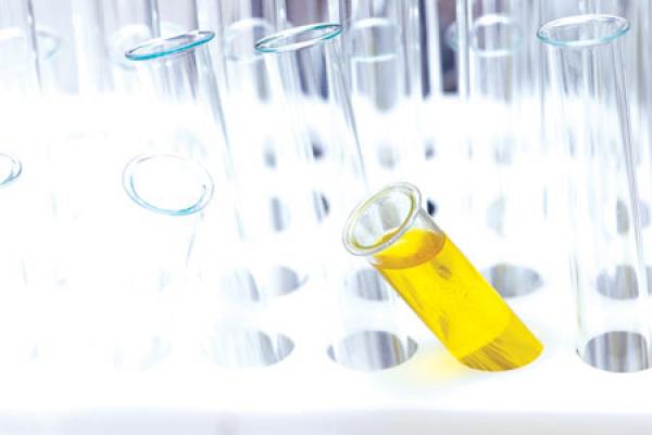 تعرف على صحتك عن طريق ألوان البول المختلفة و علاقاتها بالأمراض