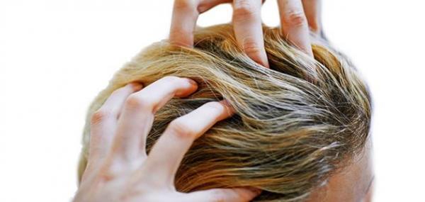 ما أسباب حكة فروة الرأس؟