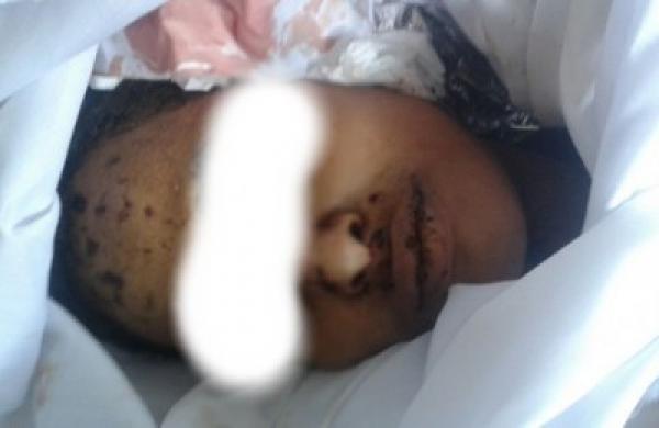 وفاة شخص بعدما ضرب رأسه مع القضبان الحديدية لمخفر أمني