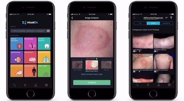 أبل أعطت تطبيقاً لأطباء بـ100 دولار في العام وهذه النتيجة