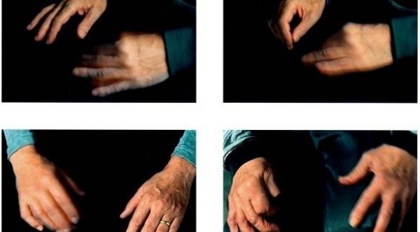 ما هو الرعاش الأساسي؟